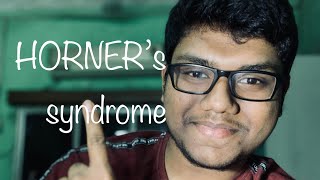 Horners Syndrome  Anatomy  Mbbs  Neet [upl. by Manup]