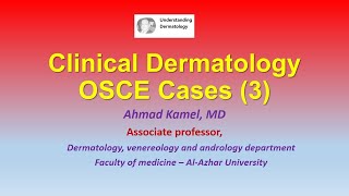 03 Clinical Dermatology OSCE Cases 3 [upl. by Nadiya]