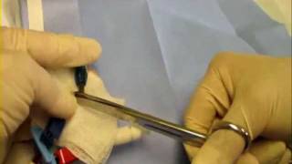 Tunelled central venous dialysis catheter Permacath repair [upl. by Ashlan]