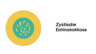 Zystische Echinokokkose  Infektionskrankheiten [upl. by Vogeley675]