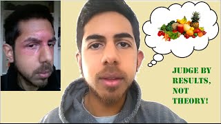 Diet for Glowing Skin  How to Heal Eczema Naturally [upl. by Seavey]