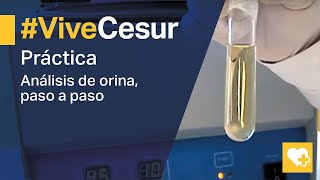 Análisis de orina 🔬 Descubre como realizarlo paso a paso 🙌 [upl. by Oyr983]