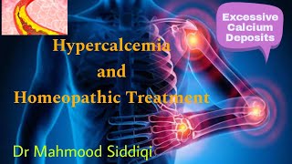 Hypercalcemia in Homeopathy [upl. by Yahsan370]