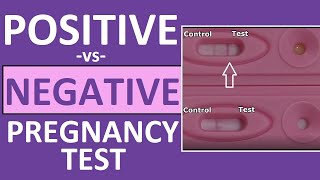 Pregnancy Test Positive vs Negative Results Time Lapse [upl. by Aeikan]