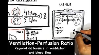 VentilationPerfusion Ratio Regional Difference In Ventilation And Blood Flow [upl. by Randene853]