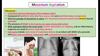 Meconium Aspiration [upl. by Tirrell]