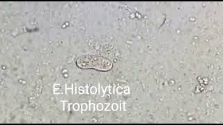 Trophozoite of Entamoeba histolytica [upl. by Yonah]