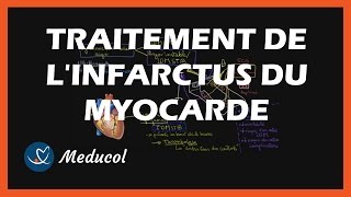 Traitement infarctus du myocarde  médicaments de lurgence thrombolyse et traitement au long cours [upl. by Yram]