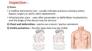 CS 2 CARDIOVASCULAR EXAMINATION  Precordium  by Dr Zaid [upl. by Carey]