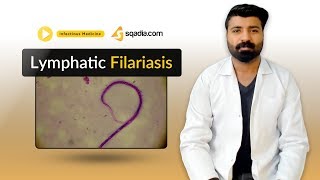 Lymphatic Filariasis  Medicine Lectures  Medical Student  VLearning  sqadiacom [upl. by Kcoj303]