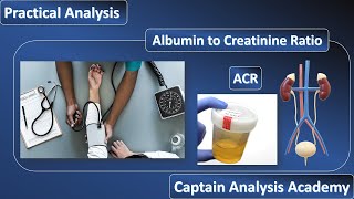 E16Albumin to Creatinine RatioMicroalbuminuriaكل ما يخص تحليل الميكروالبيومين فى البول نظرى عملى [upl. by Karina]