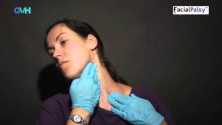 Facial Palsy DVD 2  Management of Synkinesis  Stretches for the Tight Side [upl. by Amikay]