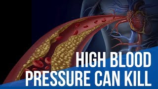 High blood pressure A silent killer [upl. by Bohlin]