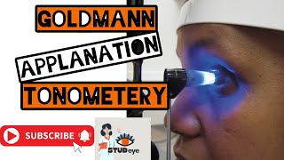 Goldmann Applanation Tonometer  Tonometry [upl. by Lyall]