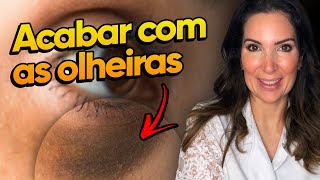 A verdade sobre como tirar as olheiras Dicas para clarear e tratar em casa comotirarolheiras [upl. by Odlabso]