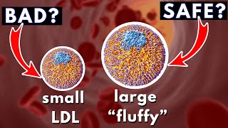 LDL size and Heart Disease small dense vs large quotfluffyquot  Dr William Cromwell [upl. by Torrance296]