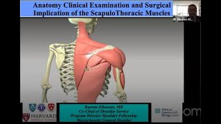 ScapuloThoracic Dissociation  DrBassem Elhassan [upl. by Swain]