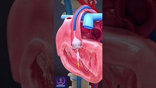 Heart Stent Aortic Valve Repair with angioplasty shorts heartstent [upl. by Ayar]