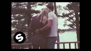 EDX  Breathin Official Music Video [upl. by Essined209]