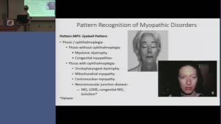 RRNMF  Pattern Recognition of Myopathic Disorders [upl. by Assirahc589]