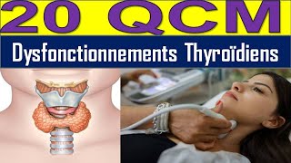 20 QCM Hyperthyroïdie ou Hypothyroïdie  Découvrez les Causes et Solutions [upl. by Helman]