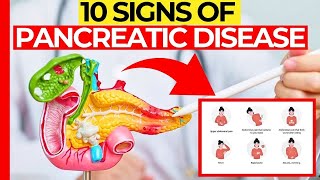 10 Signs Of Pancreatic Disease That We Ignore [upl. by Aeikan]