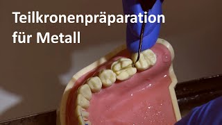 Präparation der Metallteilkrone Teilkronenpräparationen für Metall 4K [upl. by Tsuda]