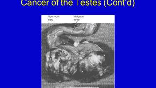 Disorders of the Reproductive System [upl. by Ajan613]