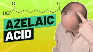 Azelaic Acid For Hair Loss  Detailed Review for 2019 [upl. by Latnahc]