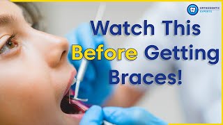 What To Know Before Getting Braces  8 Tips To Prepare You For Braces [upl. by Yboc372]