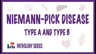 Niemann Pick Disease Type A and Type B  causes symptoms diagnosis treatment pathology [upl. by Cutcliffe]