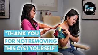 quotThank You for Not Removing this Cyst Yourselfquot Dr Lee Meets J Before Her Cyst Procedure [upl. by Hooker]