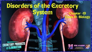 ARTIFICIAL KIDNEY  Chapter 19  Class XI  biology educationalvideo science neet [upl. by Eda]