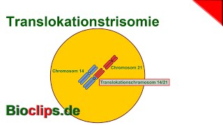 Trisomie 21 Translokation [upl. by Eiten]