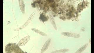 Protozoans and rotifers [upl. by Notxarb]