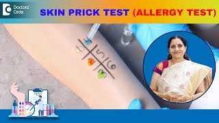 Allergy Skin Tests  SKIN PRICK TEST  How is it performed  DrP Lakshmi Satish  Doctors Circle [upl. by Bennion221]