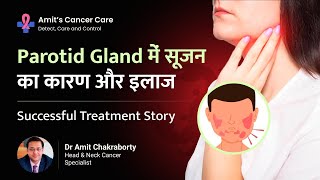 जानिए Parotid Gland Swelling का इलाज कैसे हुआ  successful cancer Treatment  Dr Amit Chakraborty [upl. by Elawalo]