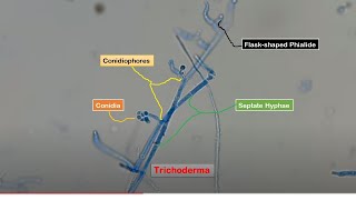 Conidia Phialides and Conidiophores of Trichoderma in LPCB Preparation [upl. by Reisman347]