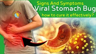 Signs And Symptoms Of Viral Stomach Bug And How To Treat [upl. by Burns]