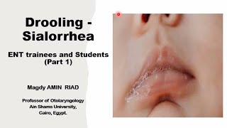 Drooling Sialorrhea ENT trainees and Students Part 1 [upl. by Aerdua214]