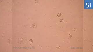 Unsporulated oocyst of coccidia [upl. by Buschi]