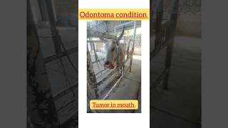 Tumor condition  Neoplasm  odontoma [upl. by Ttoile]