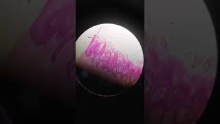 Histological slide of tongue showing filiform and fungiform papillae [upl. by Tannenwald447]