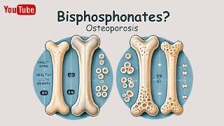 【Bisphosphonates】Pharmacology  Mechanism of Action Simply Explained [upl. by Qulllon]