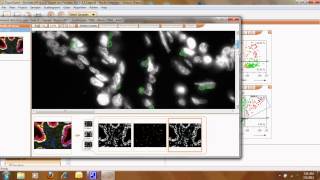 TissueQuest Cell amp Tissue Analysis Software [upl. by Yrem304]