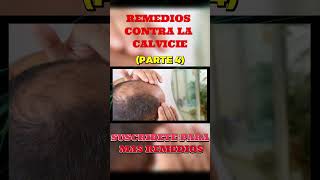 Como Combatir La Calvicie ⇐ Remedios Contra La Calvicie PARTE 4 [upl. by Hortense240]