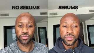 How To ELIMINATE Dark Spots Hyperpigmentation using serums Transform Your Skin [upl. by Ttenyl]