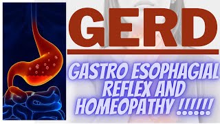 GERD  HOMEOPATHIC MEDICINE FOR GERD  GERD HOMEOPATHIC MEDICINE [upl. by Yecaw58]