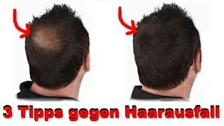 3 Tipps gegen Haarausfall [upl. by Yenruogis]