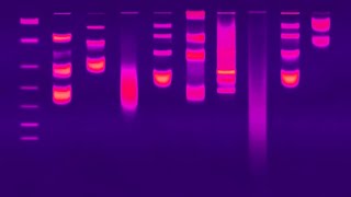 Gel Electrophoresis [upl. by Amleht9]